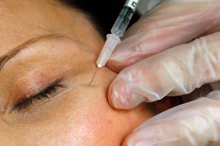 FDA warns websites selling unapproved Botox for cosmetic purposes