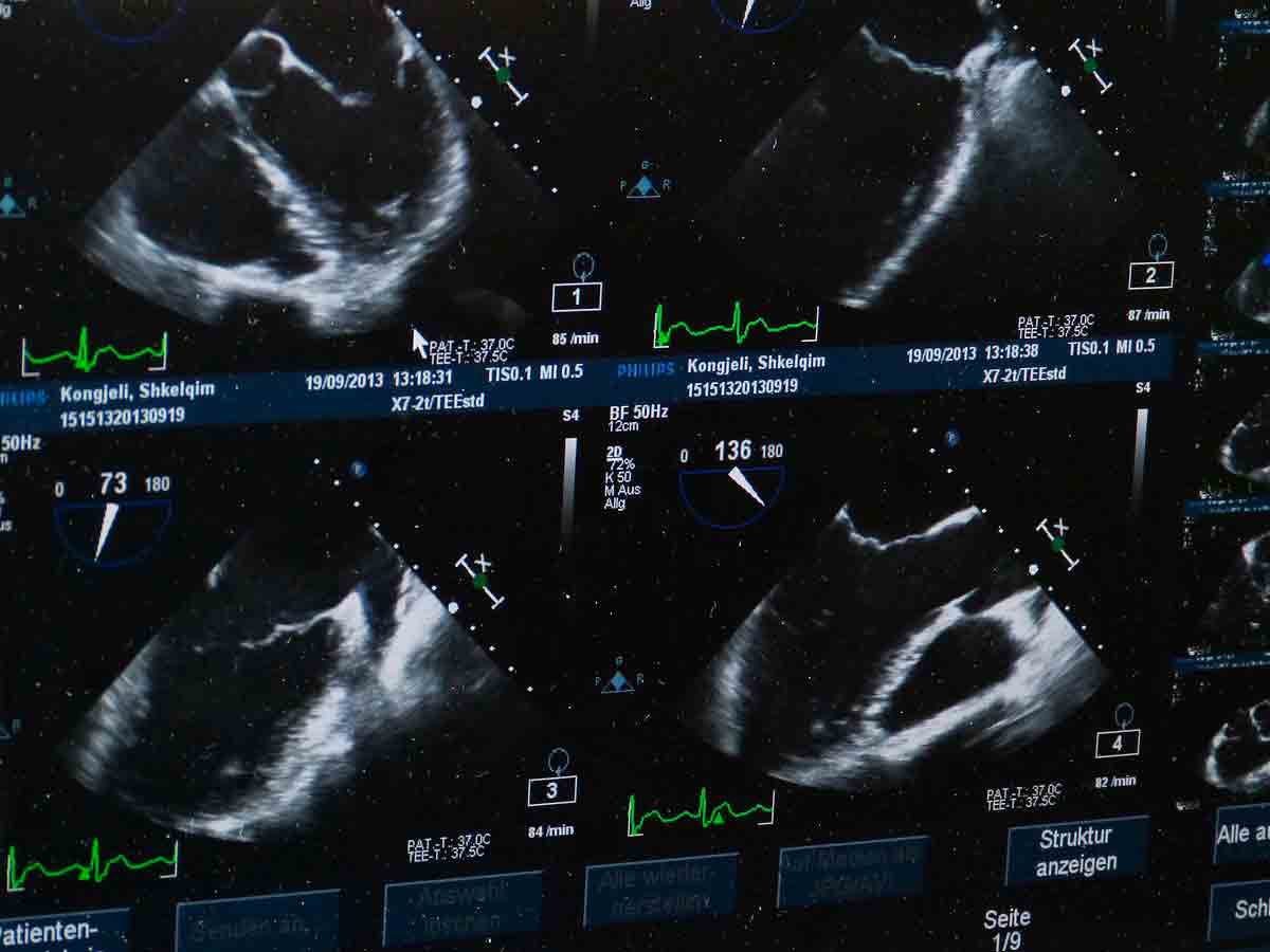 Mujer en Egipto descubre embarazo de nueve bebés; médicos alertan por el alto riesgo