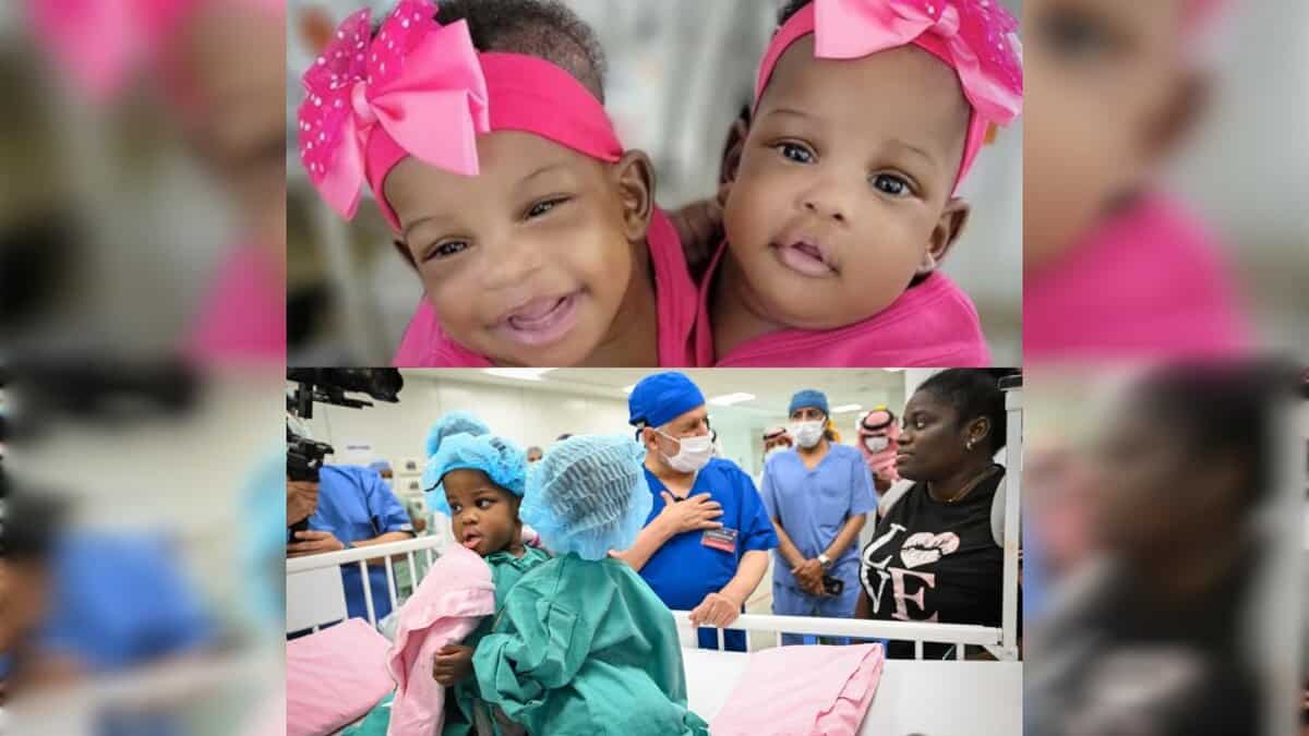 Watch: Jamaican conjoined twins separated in complex surgery in Saudi Arabia