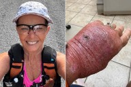 Woman Gets Paper Cut, Is Rushed to Hospital After Removing Bandages (Exclusive)