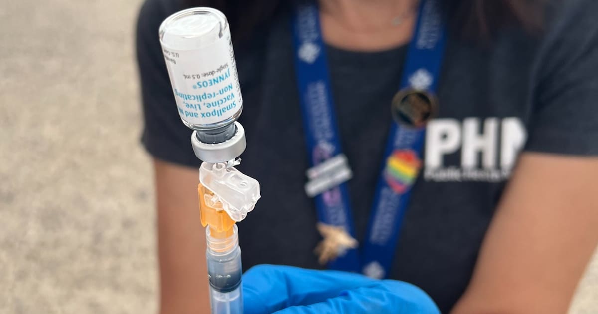 Aumentan casos del virus del mono al doble en San Diego