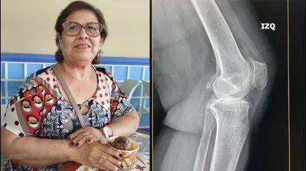 Mujer denuncia retraso de su operación en Hospital de la FAP porque llamaron a su esposo fallecido hace meses