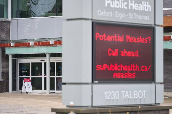 Canada Loses Measles Elimination Status. Will The U.S. Soon Follow?