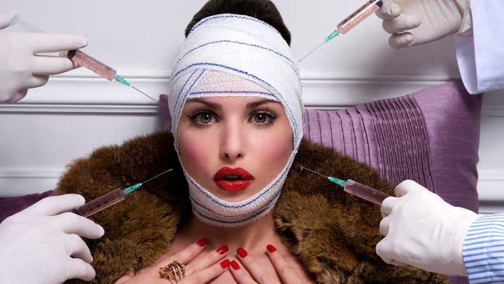 What is filler fatigue and why subtle tweakments are on the rise