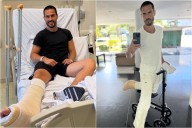 Imágenes sensibles. Juan Marconi mostró la impresionante cicatriz que le quedó tras la operación del tendón de Aquiles