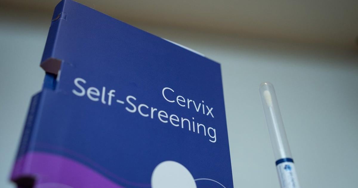 Canada may fall short of goal to eliminating cervical cancer by 2040, cancer society says