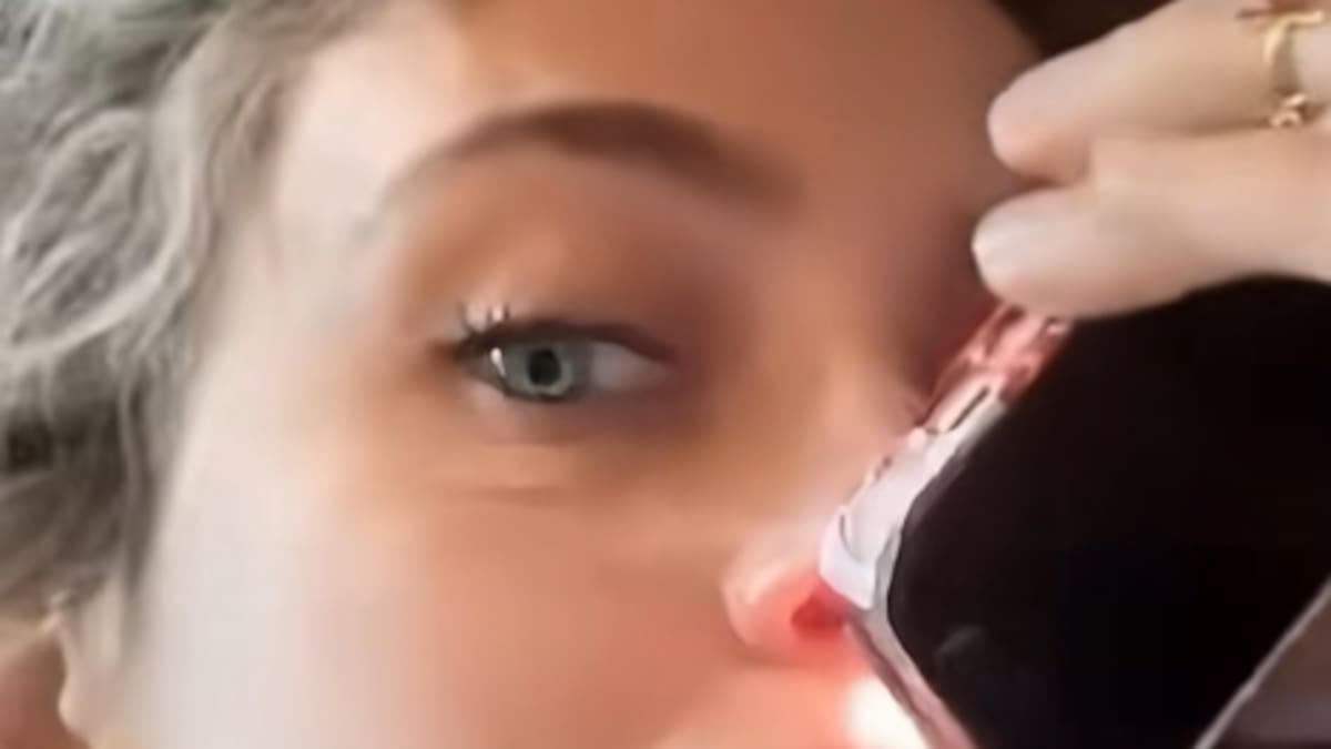 La hija de Michael Jackson muestra las consecuencias que le ha dejado el consumo de drogas en el tabique