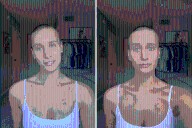 I Found a Lump on My Collarbone—the Diagnosis Turned My Life Upside Down