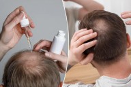 Experimental serum could reverse baldness within 20 days
