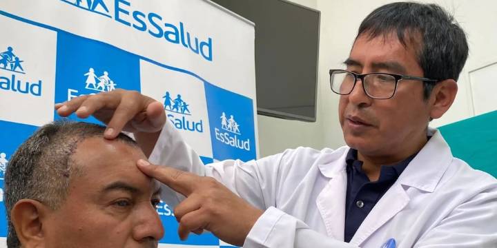Callao: hombre de 65 años recupera movilidad y visión luego de operación de 10 horas para retirar tumor cerebral