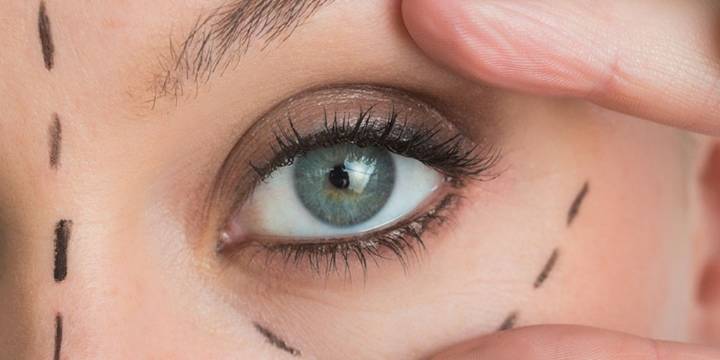 Cirugías estéticas en Perú, una industria que mueve millones: ¿cuánto cuesta un tratamiento, y qué operaciones son las más demandadas?