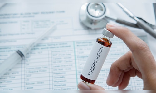WHO lauds India for making 'encouraging gains' to end tuberculosis