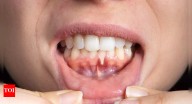 8 health problems that show up in your teeth and gums: What your smile reveals about your wellness