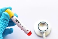 Alerta sífilis: los casos se incrementaron un 20,5% en Argentina