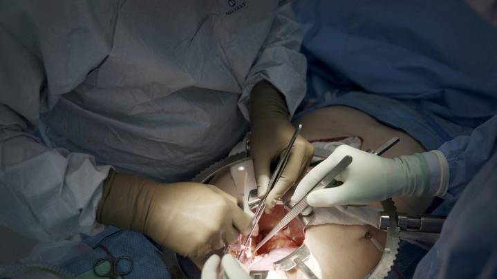 First clinical trial of pig kidney transplants gets underway
