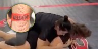 Una luchadora mostró cómo le quedó el brazo tras sufrir múltiples mordeduras de su rival durante el combate: “Dejaré que las marcas hablen”