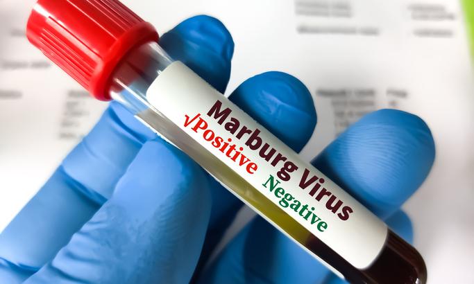 Ethiopia confirms 3 Marburg virus deaths in new outbreak