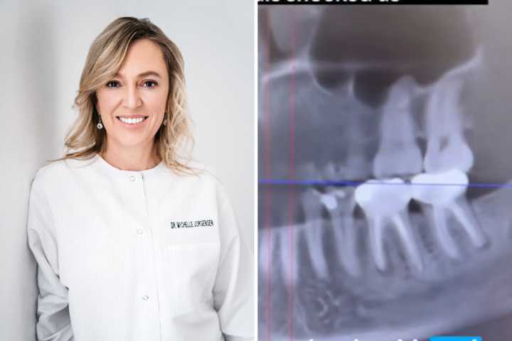 Dentist Checks Cancer Patient’s Mouth, Shock Over What’s Seen in Root Canal