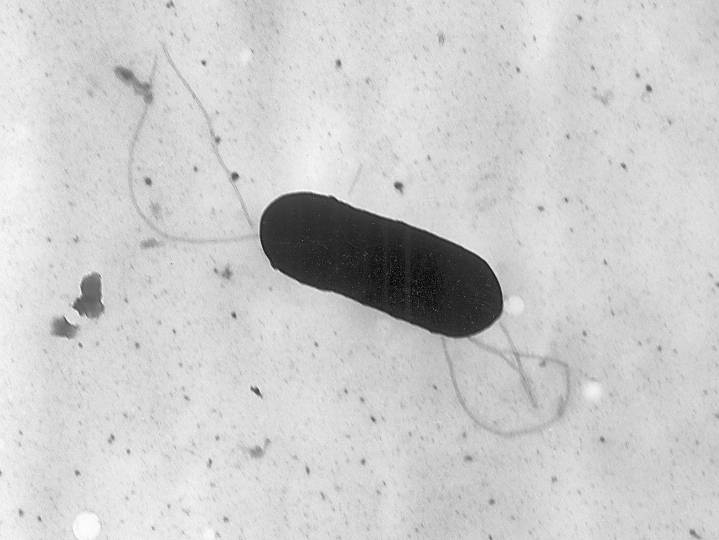 Class-action lawsuit over listeria outbreak reaches $6.5