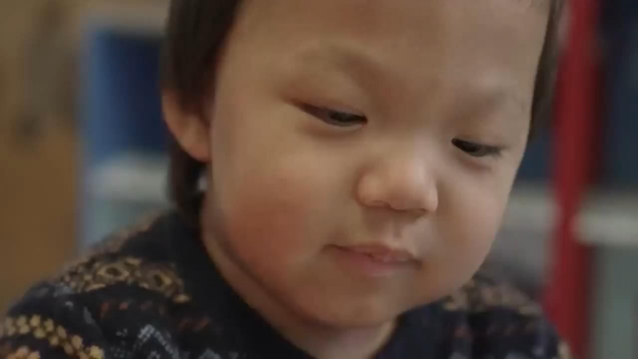 Child with Hunter Syndrome amazes doctors in world