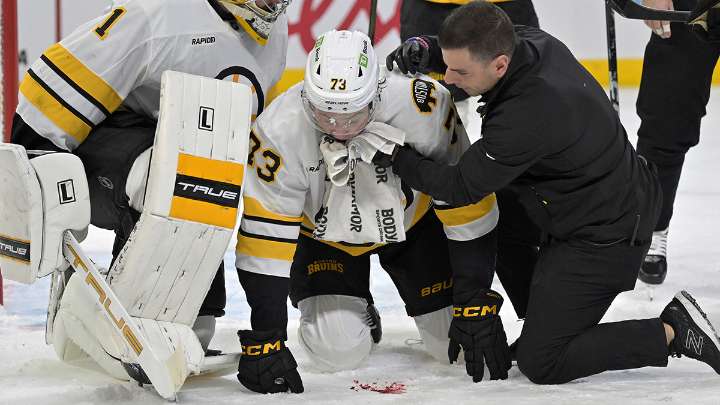 Charlie McAvoy injury update after Bruins star takes puck to face in Montreal