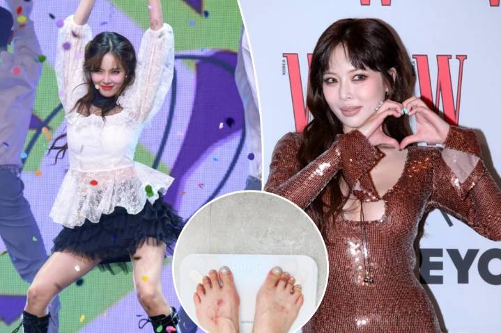 K-pop star HyunA collapses mid-performance, sparking concern over recent weight loss