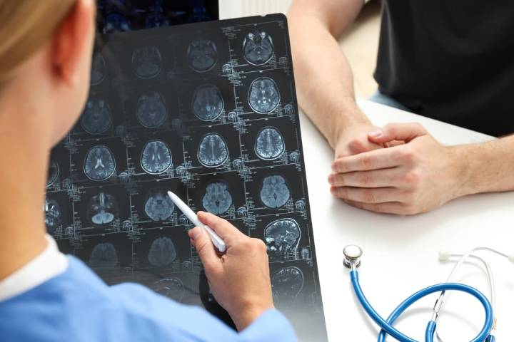Aumentan los casos de derrame cerebral en jóvenes ¿Cuáles son las causas y cómo evitarlo?