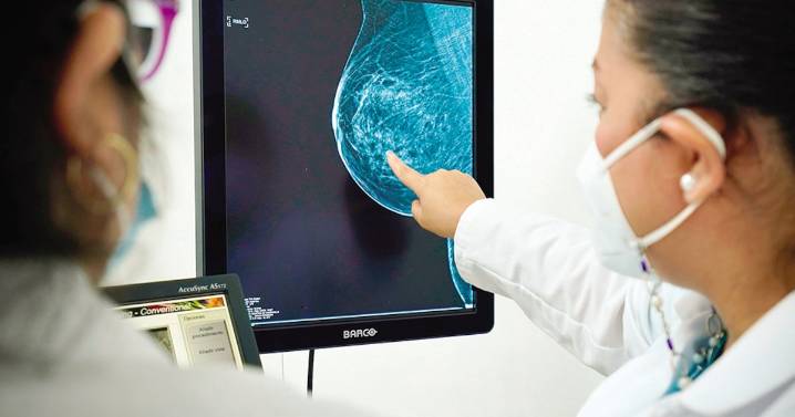 Buscan mejor atención para el cáncer de mama