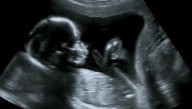 Update: 3,000 New Deaths Today But Enough About Abortion