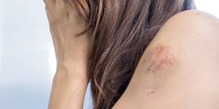 Guanajuato en el top 10 de los estados con más llamadas al 911 por violencia contra la mujer