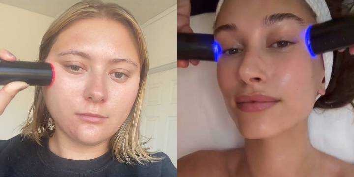 Lyma Laser 101: What It Is & The Results, According to Cosmo Editors