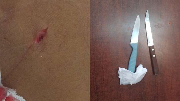 Violenta pelea por el robo de un celular dejó un herido de arma blanca