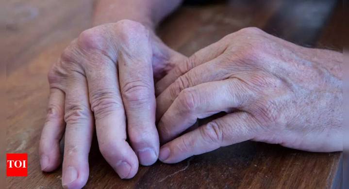 How Psoriatic arthritis impacts your body: Know the effects on joints, skin, nails, organs and overall health