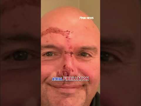 OUCH!: Fetterman reveals bloody face after fall sends him to hospital #shorts #usa #politics