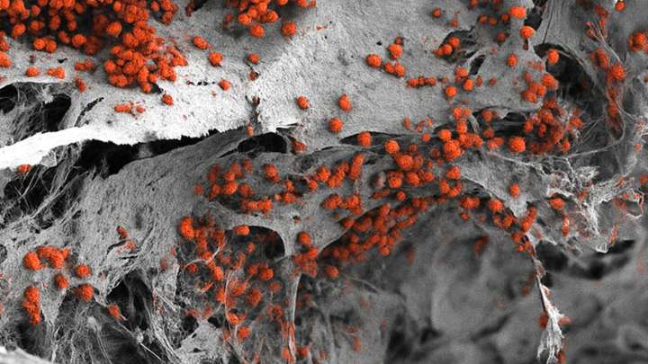 Construyen una "fábrica de sangre" en un laboratorio: una médula ósea humana