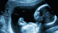 Report: More Unborn Babies In New York Identifying As Convicted Criminals So They Can't Legally Be Executed