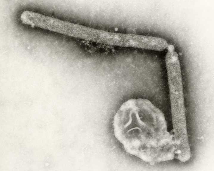 First human case of rare bird flu reported in Washington state. Are you at risk? Updated 1 hour ago