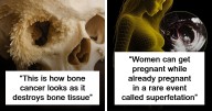 121 Incredible Facts About The Human Body That School Never Taught You