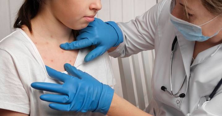 UKHSA issues alert over disease that is 'nearly twice as contagious' as a cold