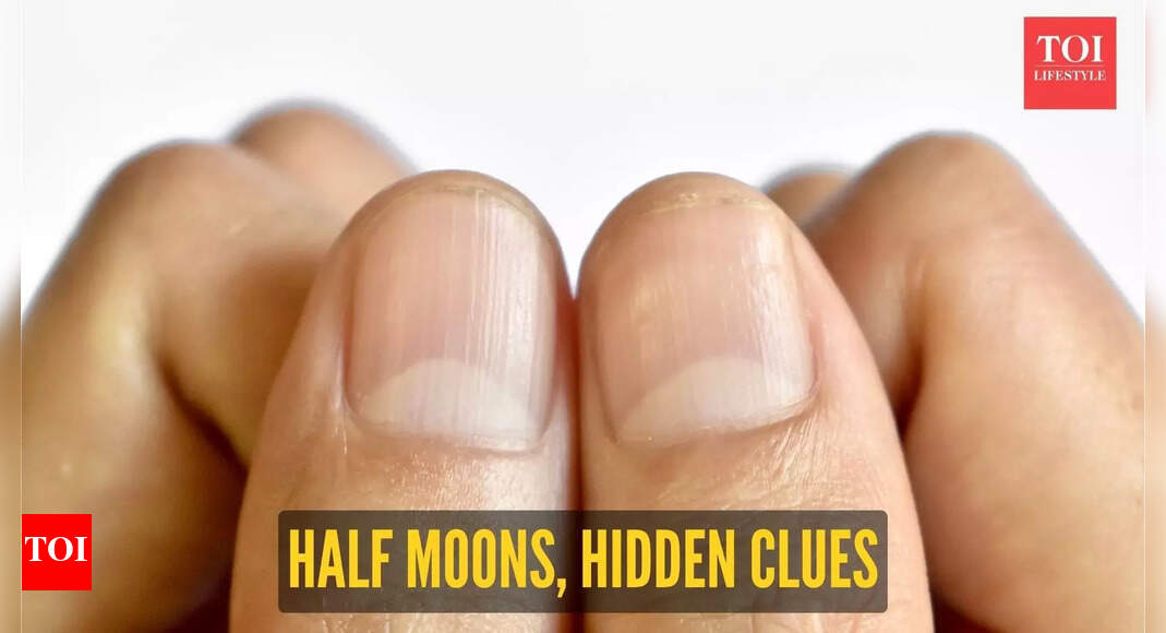 From kidney disease to heart health: What our nail’s half moon says about our health and when to worry
