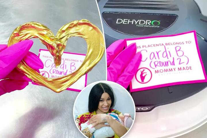 Cardi B has umbilical cord made into gold jewelry after giving birth