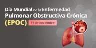 Tabaquismo, principal causa de EPOC en México