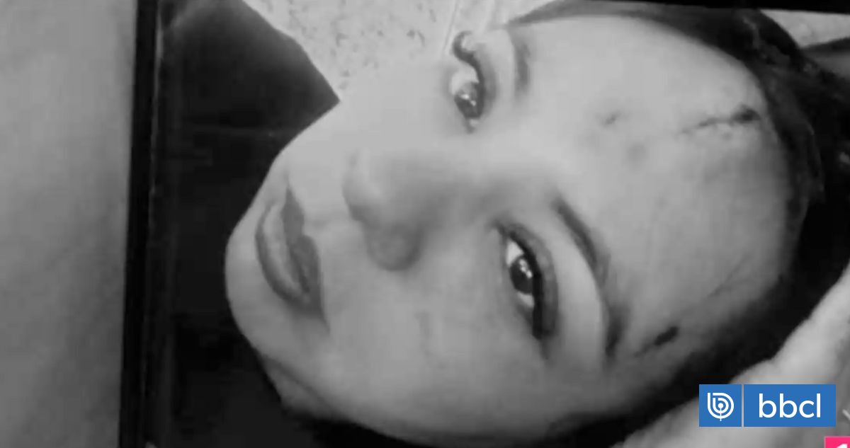 Brutal agresión contra hermana de Krishna Aguilera deja evidentes cortes y moretones en su rostro