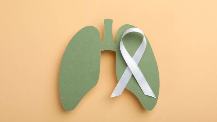 2025 report shows Utah has low rate of new lung cancer diagnoses