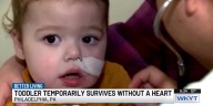 Better Living: Toddler temporarily survives without a heart