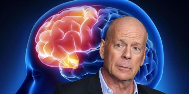 Familia de Bruce Willis decidió donar su cerebro tras su muerte
