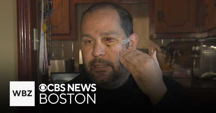 Former Fall River mayor details random stabbing attack