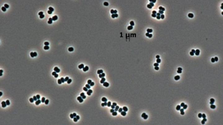 NASA discovered a bacteria that can ‘play dead’