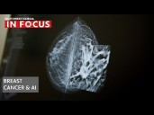 Artificial Intelligence joins the battle against breast cancer