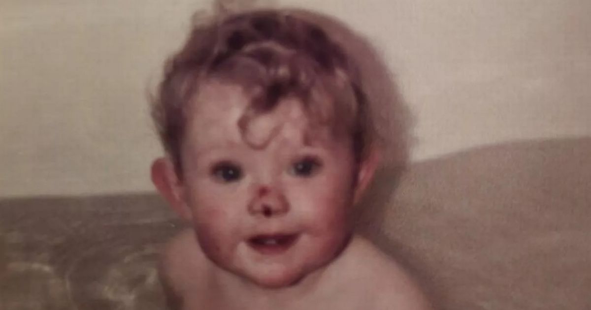 Lanarkshire mum's rare 'butterfly skin' condition sparked child abuse concerns